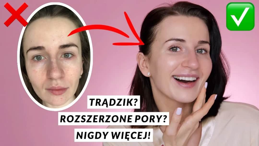 Jak mieć idealną cerę: 10 skutecznych sposobów na piękną skórę