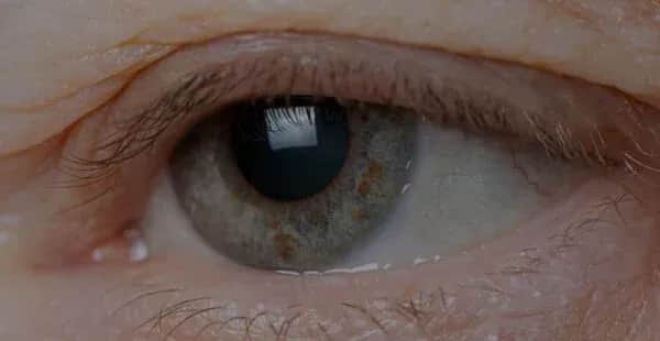 Blefaroplastyka a widzenie – czy zabieg poprawia pole widzenia?