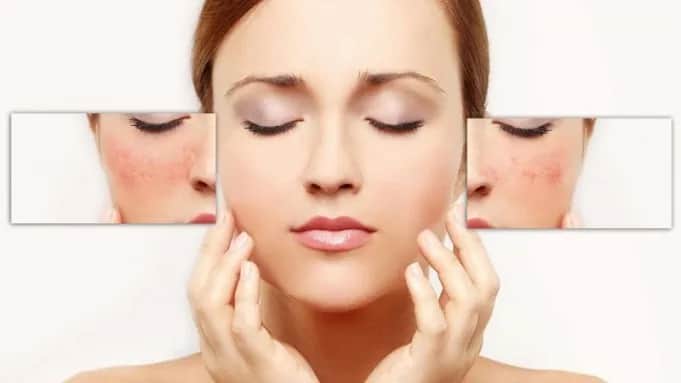 Cera naczynkowa - jak wygląda i jak ją rozpoznać? Poradnik